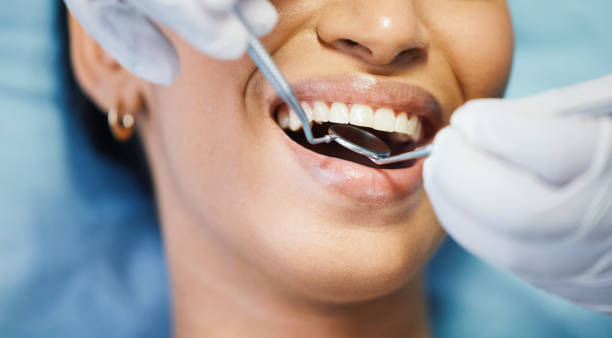Best Emergency Dental Care for Broken or Chipped Teeth in Lincoln, IL