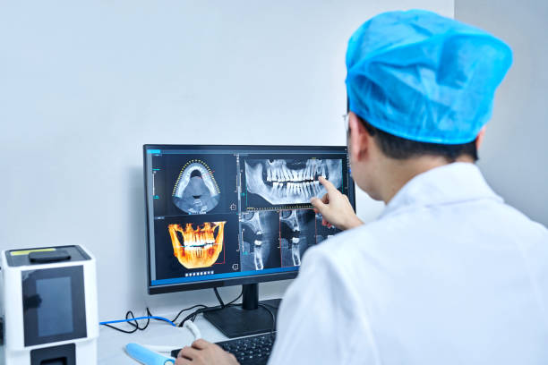 Best Emergency Root Canal Treatment in Lincoln, IL