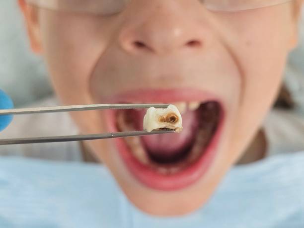 Best Emergency Denture Repair in Lincoln, IL