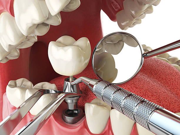 Best Pediatric Emergency Dentist in Lincoln, IL